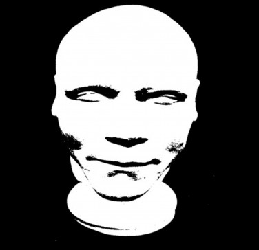 William Burke's death mask as displayed at Edinburgh University's fascinating Anatomy Museum